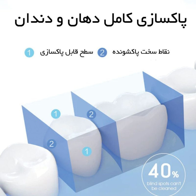 واترجت دهانشوی شیائومی مدل SOOCAS Portable Oral Irrigator W3 Pro